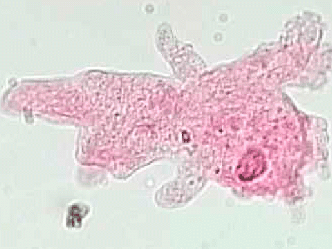 Биологи изучили механизм влияния амебы на организм человека