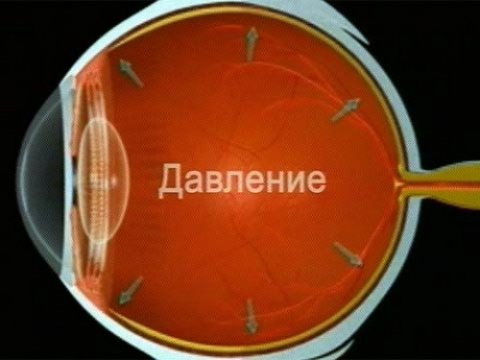 Созданы контактные линзы, позволяющие определить глазные болезни