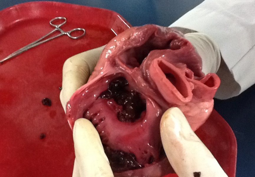 3D-технологии помогут хирургам в лечении сердечно-сосудистых патологий