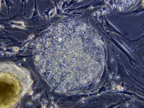 Рак можно победить при помощи стволовых клеток