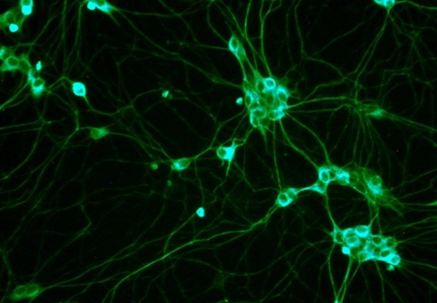 Стволовые клетки костного мозга, могут стать решением проблемы инфарктов