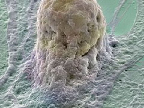 Стволовые клетки нового поколения