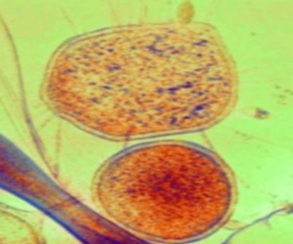 Ученые обнаружили самых маленьких и странных микробов