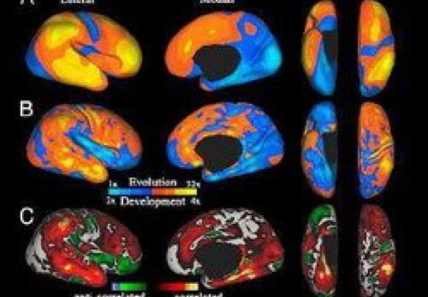 Развитие человеческого мозга представляет собой мини-эволюцию