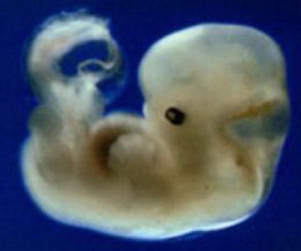 Избыточные регуляторы делают развитие эмбриона помехоустойчивым