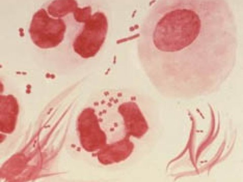 Гонорея заразилась человеческой ДНК