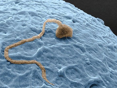 Ученым удалось получить искусственный сперматозоид