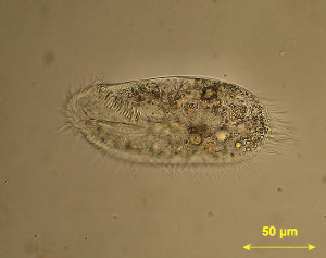 Инфузория окситриха (фото с сайта www.gpmatthews.nildram.co.uk)