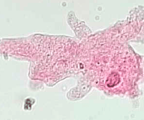 Биологи изучили механизм влияния амебы на организм человека