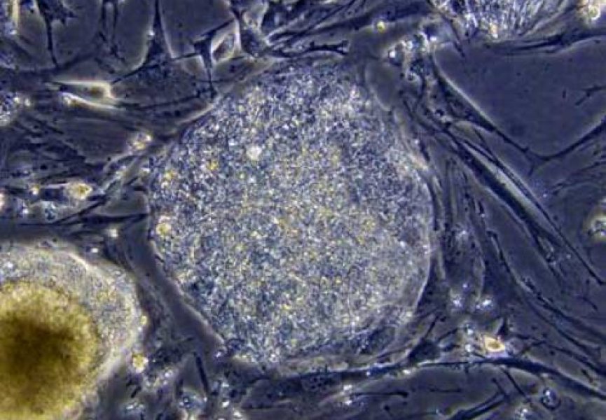 Рак можно победить при помощи стволовых клеток