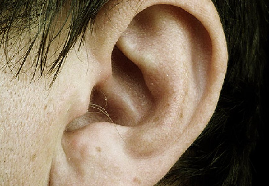 За шум в ушах отвечают гены