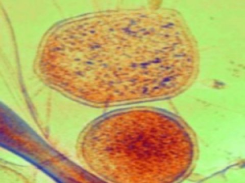 Ученые обнаружили самых маленьких и странных микробов