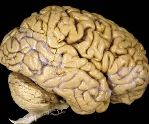 Ученые выявили связь между курением и структурой отдельных областей мозга