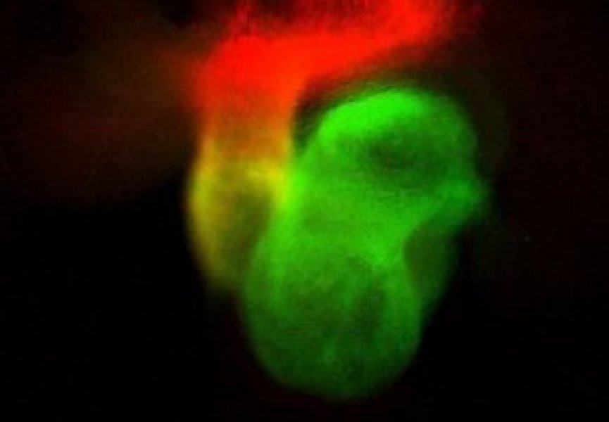 Ученые вырастили сердце из стволовых клеток