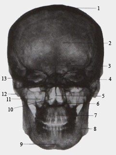 Рентгеновская картина черепа взростлого человека (вид спереди)
